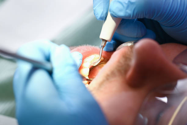 Best Pediatric Emergency Dentist in North Massapequa, NY